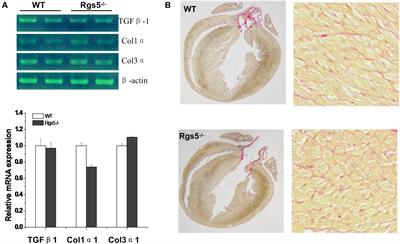 Absence of Rgs5 Influences the Spatial and Temporal Fluctuation of Cardiac Repolarization in Mice